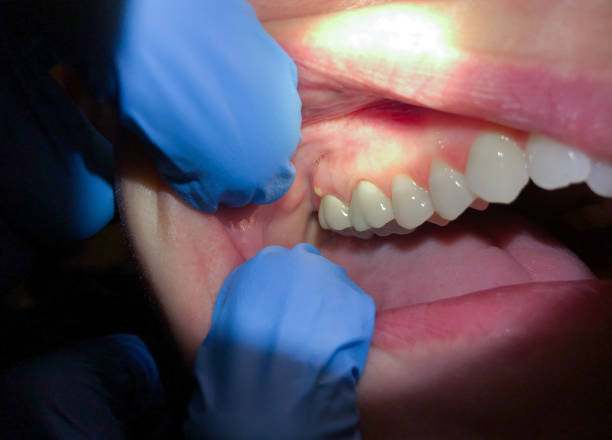 Best Emergency Treatment for Jaw Pain or Injury in Ebensburg, PA