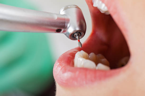 Best Lost Filling or Crown Replacement in Ebensburg, PA